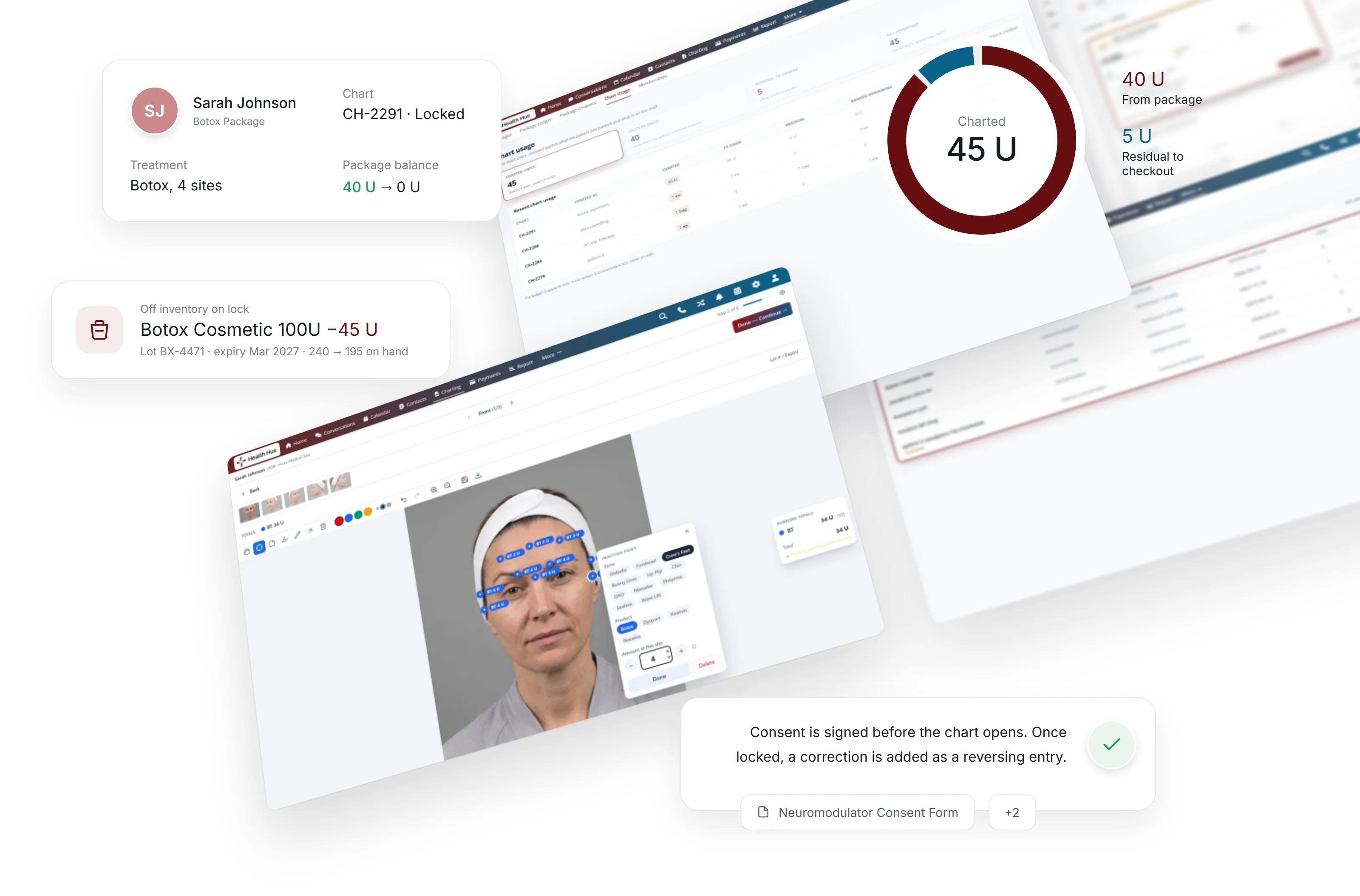 Health Hue clinical, a Botox chart with injection sites pinned on the face beside chart usage, stock by lot and membership programs, with the package balance and residual it produced