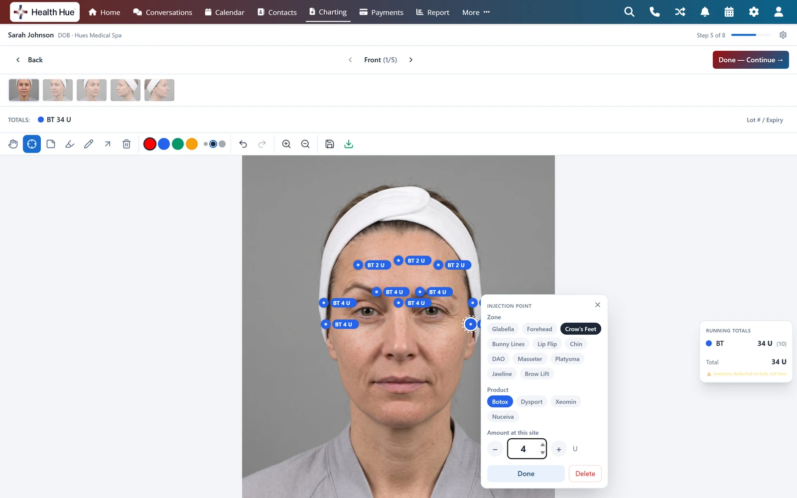 Health Hue Charting on a laptop: a patient's front photograph with ten Botox injection sites pinned and the injection point panel open, beside the mobile app.