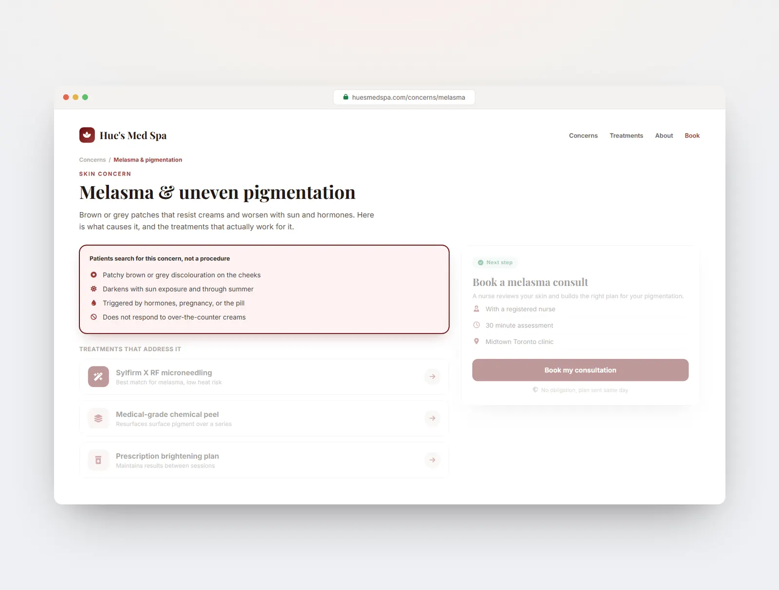 A Hue's Med Spa concern page for melasma, organised around the problem patients actually search for.