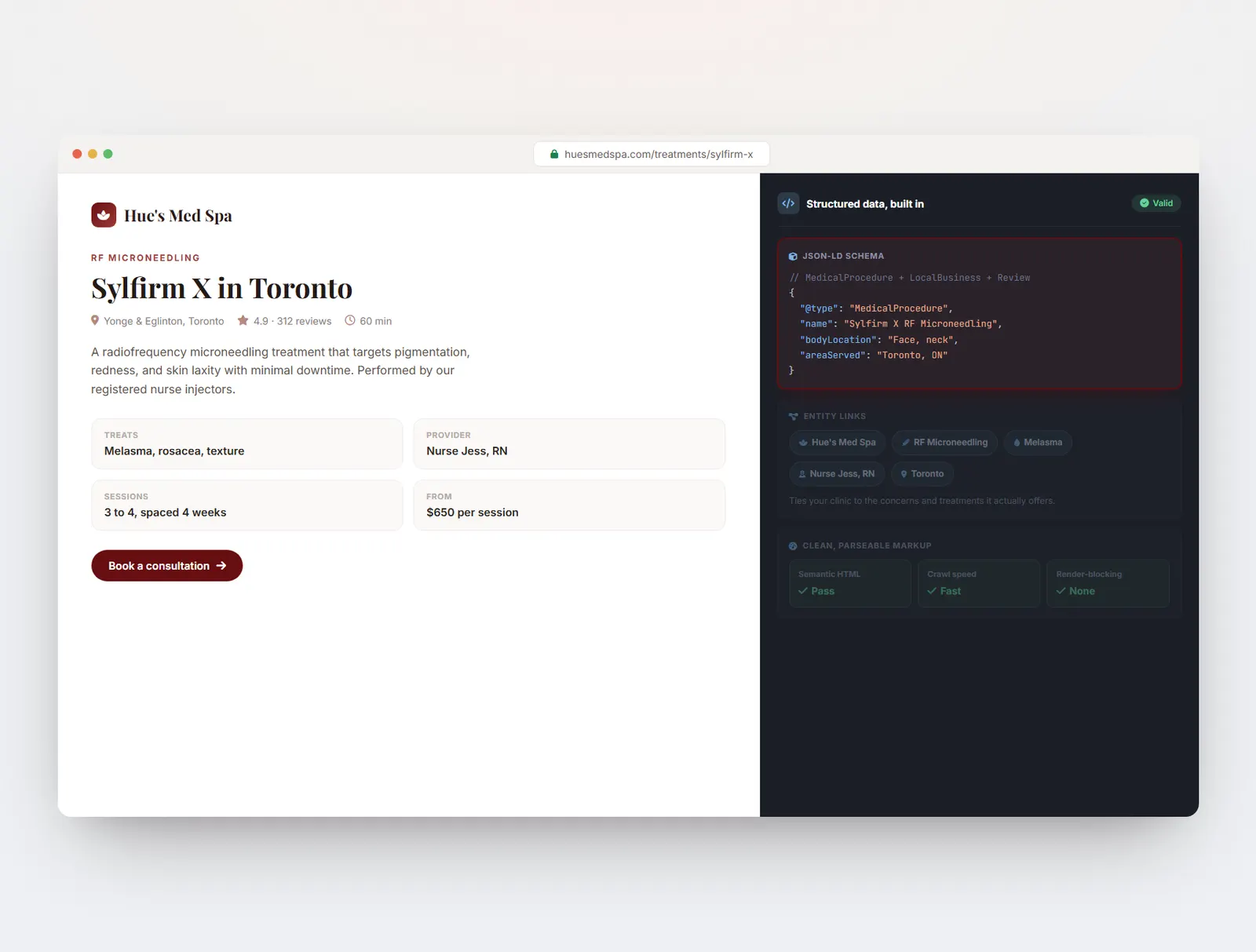 A Hue's Med Spa treatment page beside its built-in JSON-LD schema for the procedure, location, and reviews.