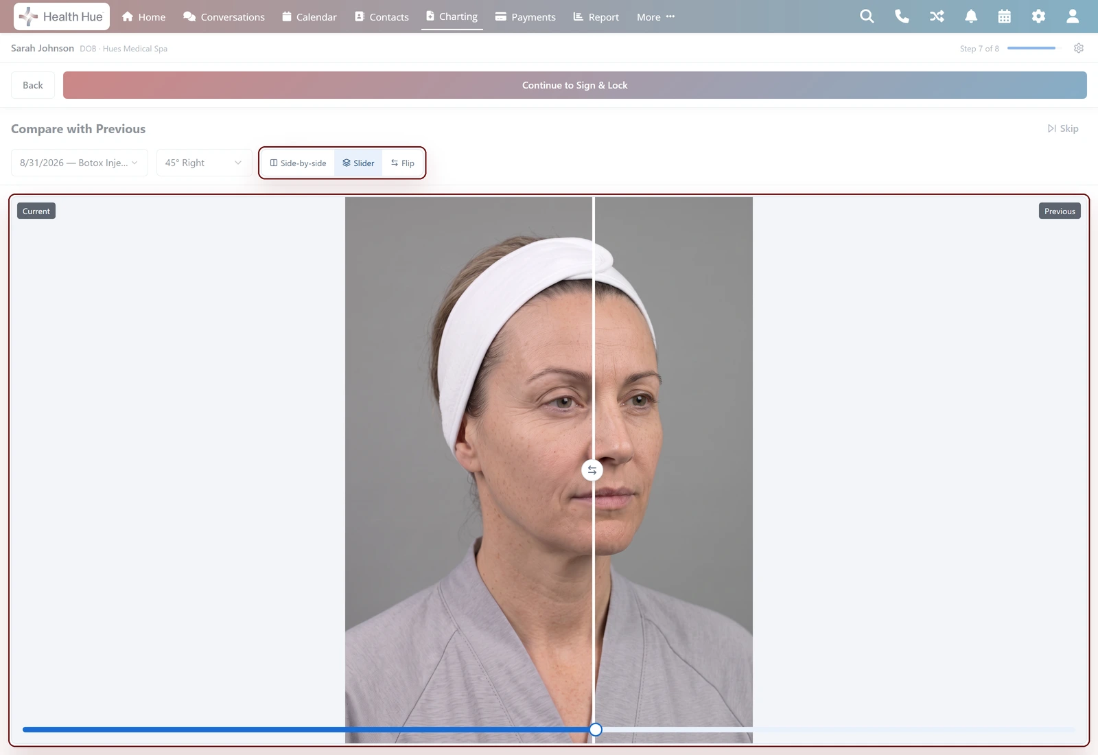 Before and after in the Health Hue Hub.