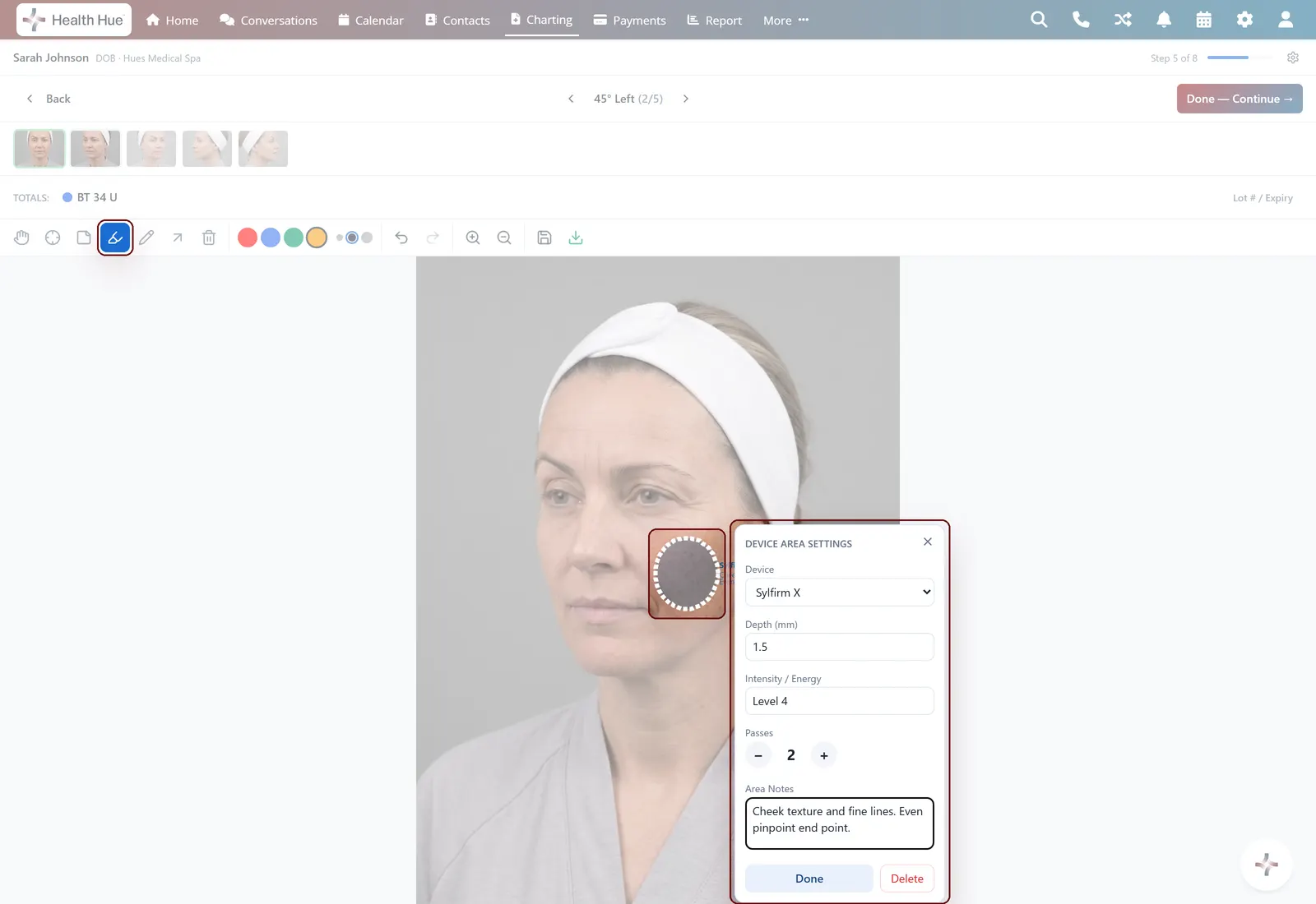 Device areas in the Health Hue Hub.