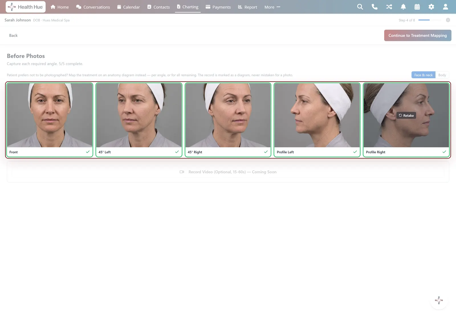 The Photos panel with a single-session under-eye before-and-after pair highlighted.