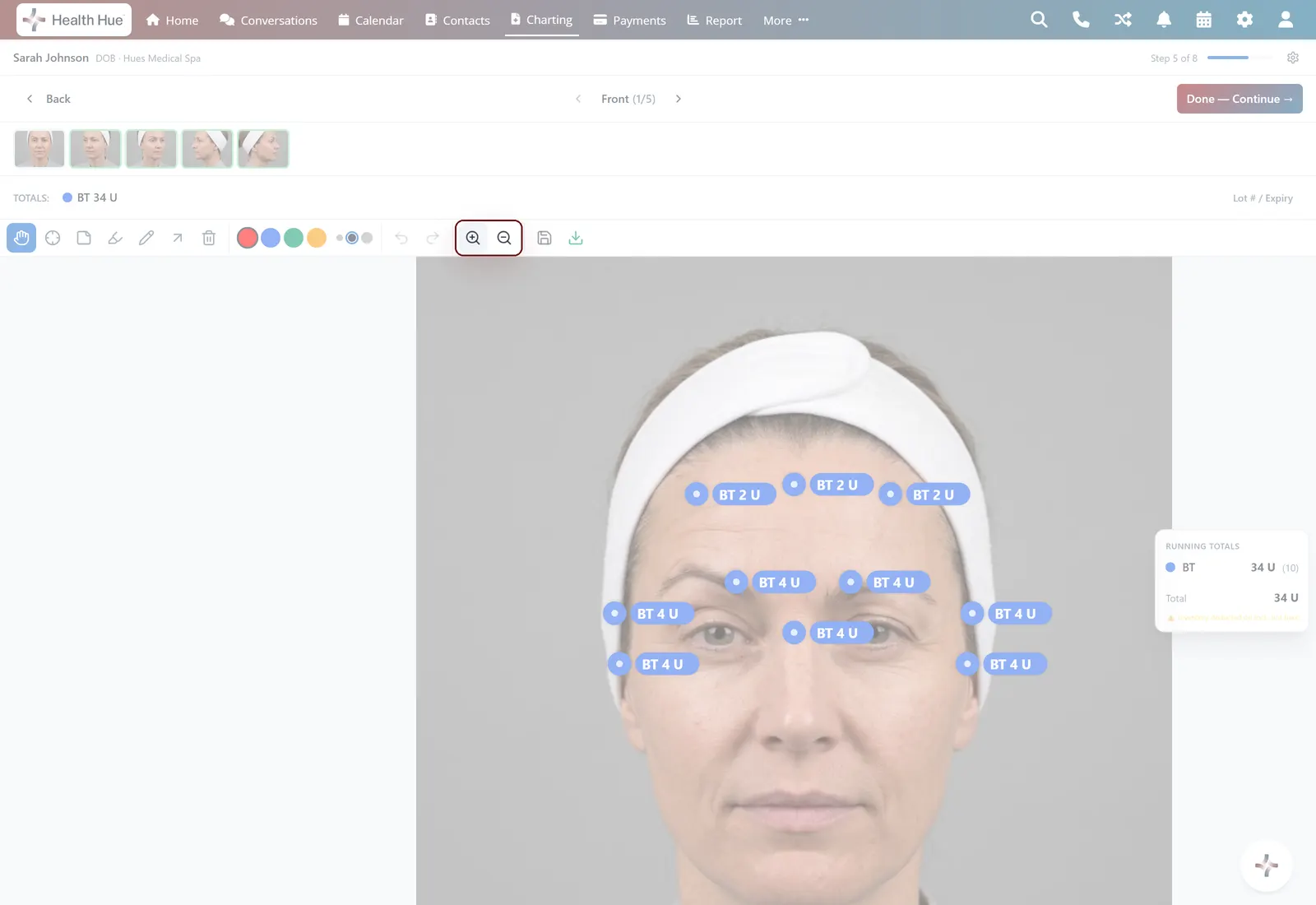 Zoom and undo in the Health Hue Hub.