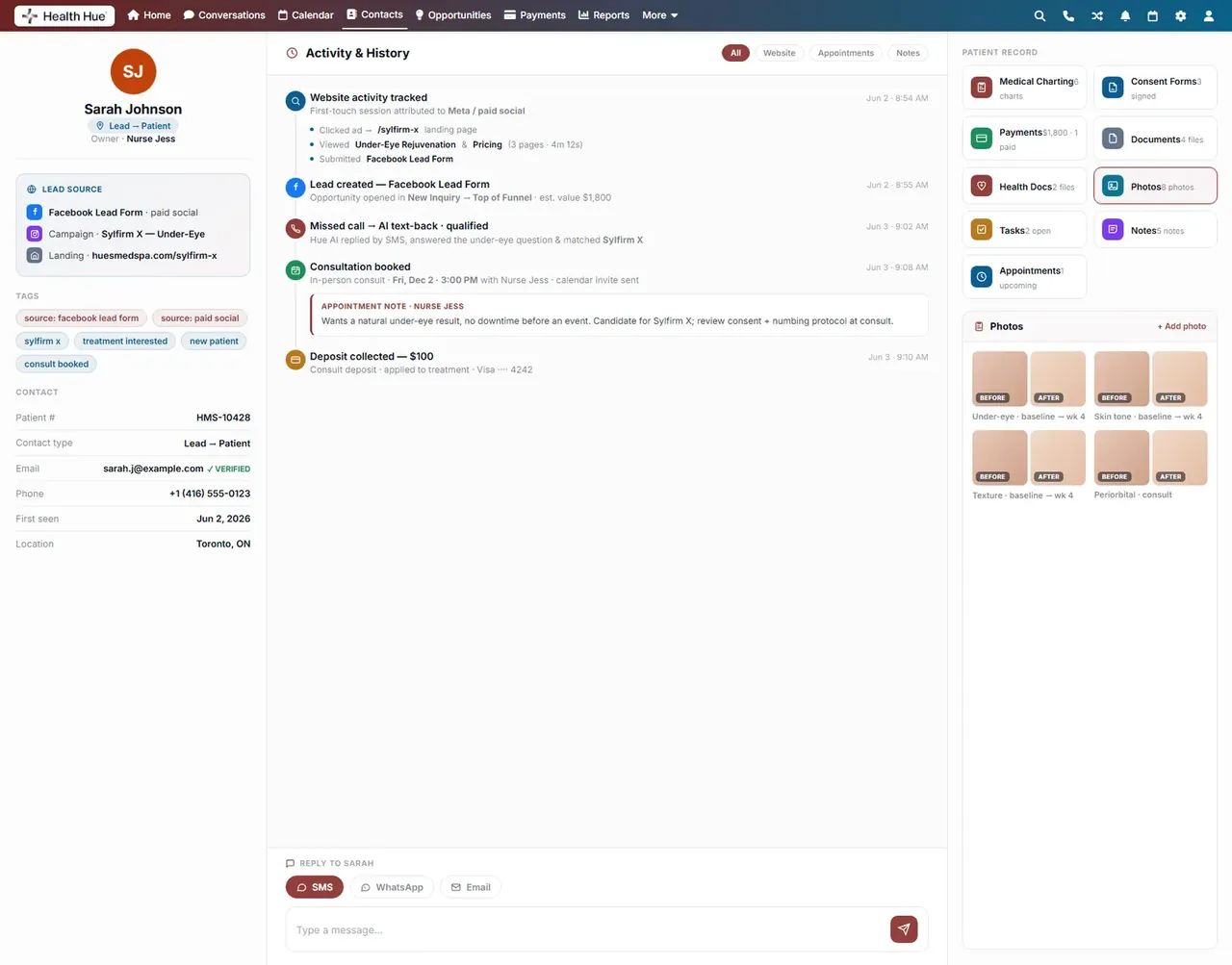 The treatment-photo gallery on a Health Hue Hub patient record, showing before-and-after images.
