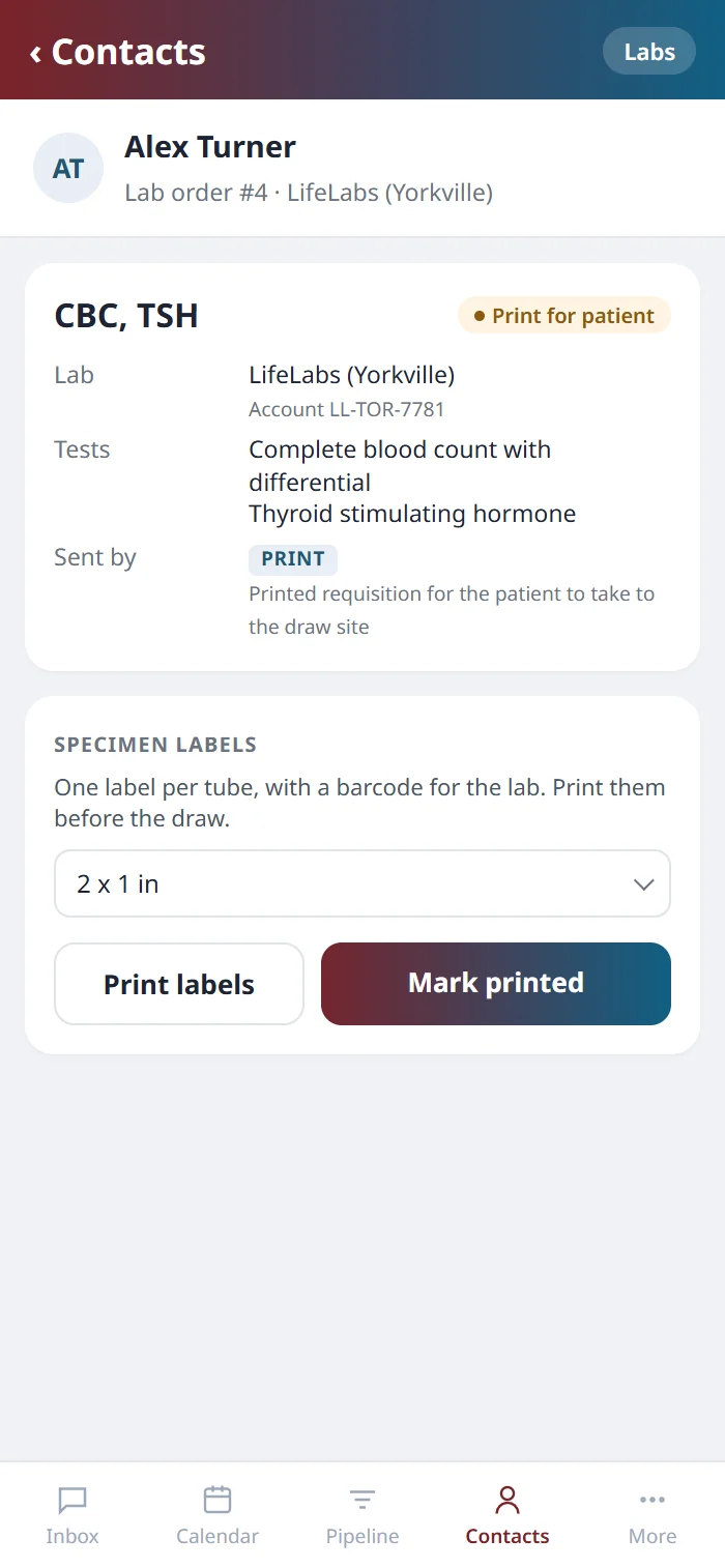 A lab order on the Health Hue mobile app set to print for the patient, with the specimen labels ready to print.